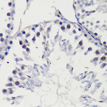 Anti-CDKN1B/p27KIP1 Antibody (CAB15632)