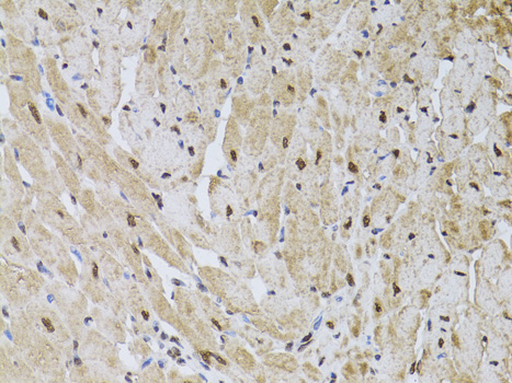 Anti-HUS1 Antibody (CAB13938)