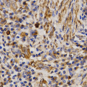 Anti-MMP25 Antibody (CAB3032)