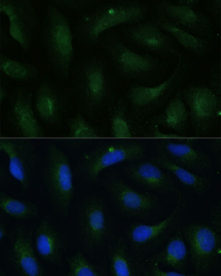 Anti-COPG2 Antibody (CAB15817)