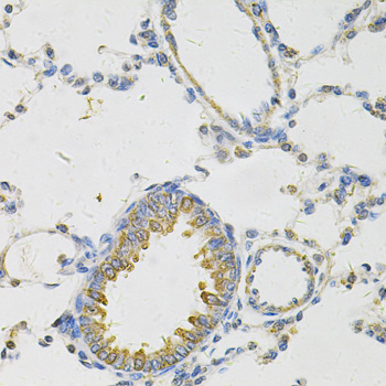 Anti-PON2 Antibody (CAB14048)