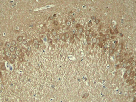 Anti-Phospho-MAPT-T181 Antibody (CABP0399)