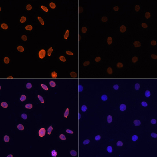 Anti-Acetyl-Histone H2B-K12 Antibody (CAB15619)