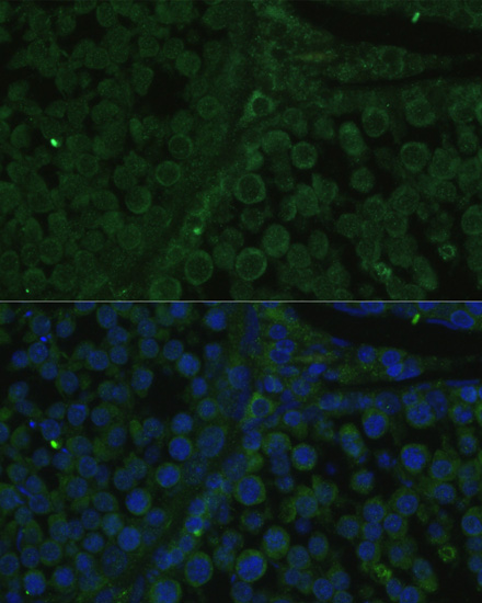 Anti-IGF2BP2 Antibody (CAB1774)