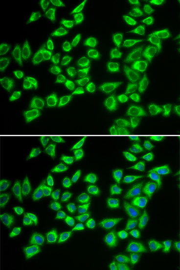 Anti-HADHB Antibody (CAB5716)