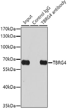 Anti-TBRG4 Antibody (CAB0276)