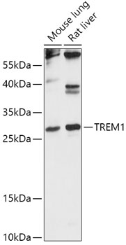 Anti-TREM1 Antibody (CAB16535)