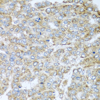 Anti-NDUFA2 Polyclonal Antibody (CAB8136)