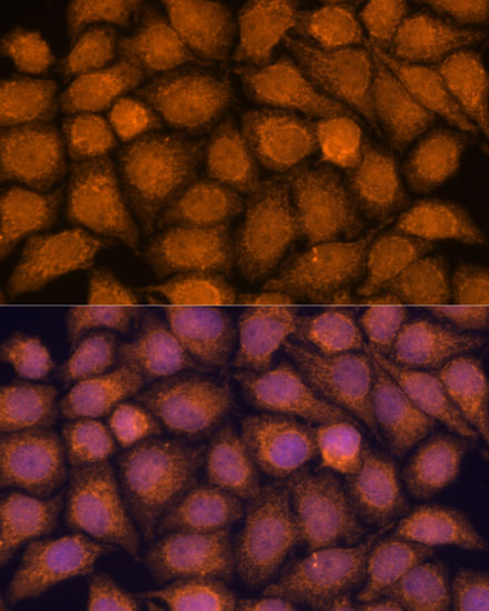 Anti-TNFAIP8L2 Antibody (CAB13698)