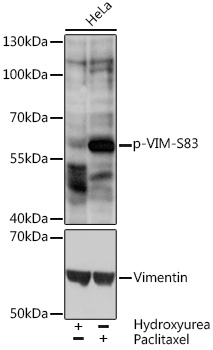 Anti-Phospho-VIM-S83 pAb (CABP0799)