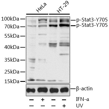 Anti-Phospho-Stat3-Y705 Antibody (CABP0070)