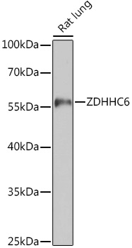 Anti-ZDHHC6 Antibody (CAB18113)