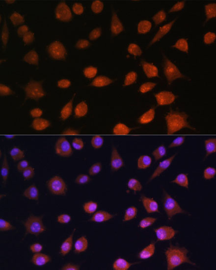 Anti-RPS19BP1 Antibody (CAB13231)