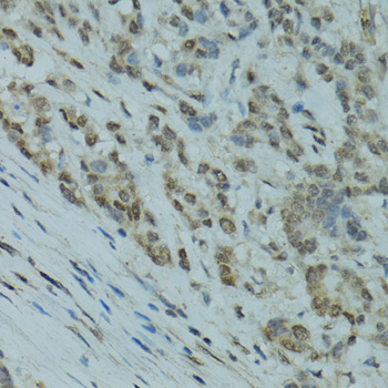 Anti-GABPA Polyclonal Antibody (CAB8419)