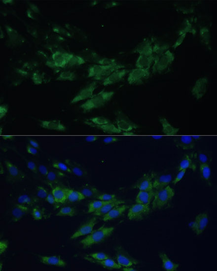 Anti-EPHA4 Polyclonal Antibody (CAB8346)