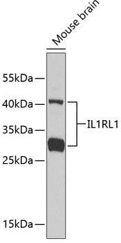 Anti-IL-1RL1 Antibody (CAB1913)