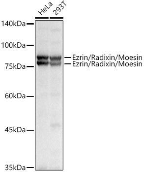 Western blot analysis of extracts of various cell lines, using Ezrin/Radixin/Moesin antibody at 1:1000 dilution. Secondary antibody: HRP Goat Anti-Rabbit IgG (H+L) at 1:10000 dilution. Lysates/proteins: 25ug per lane. Blocking buffer: 3% nonfat dry milk in TBST. Detection: ECL Basic Kit. Exposure time: 0. 8s.