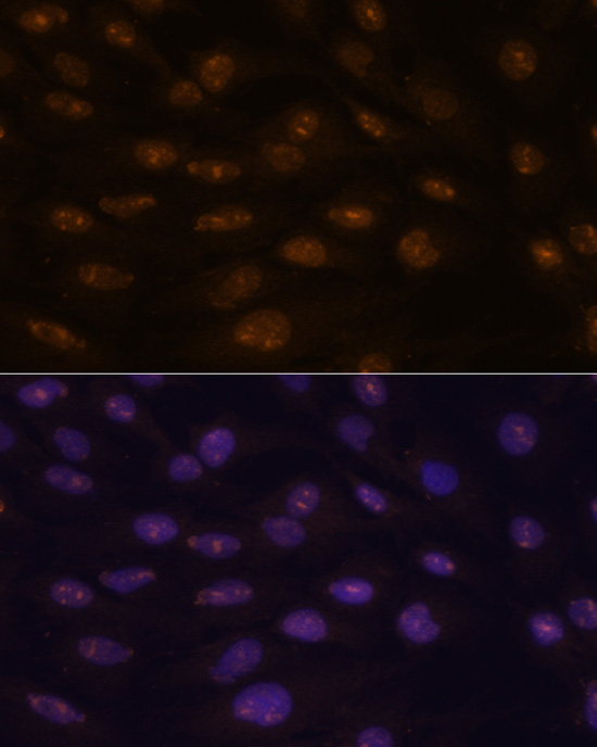 Anti-MYOD1 Antibody (CAB0671)