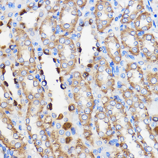 Anti-HLA-DRA Antibody (CAB1579)