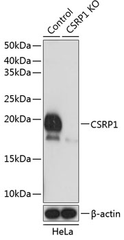 Anti-CSRP1 Antibody [KO Validated] (CAB19842)