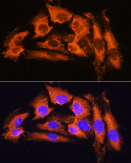 Anti-APRT Antibody (CAB13946)