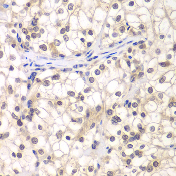 Anti-USF1 Antibody (CAB13560)