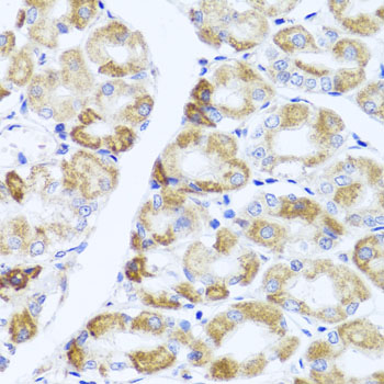 Anti-PIK3CA Antibody (CAB12484)