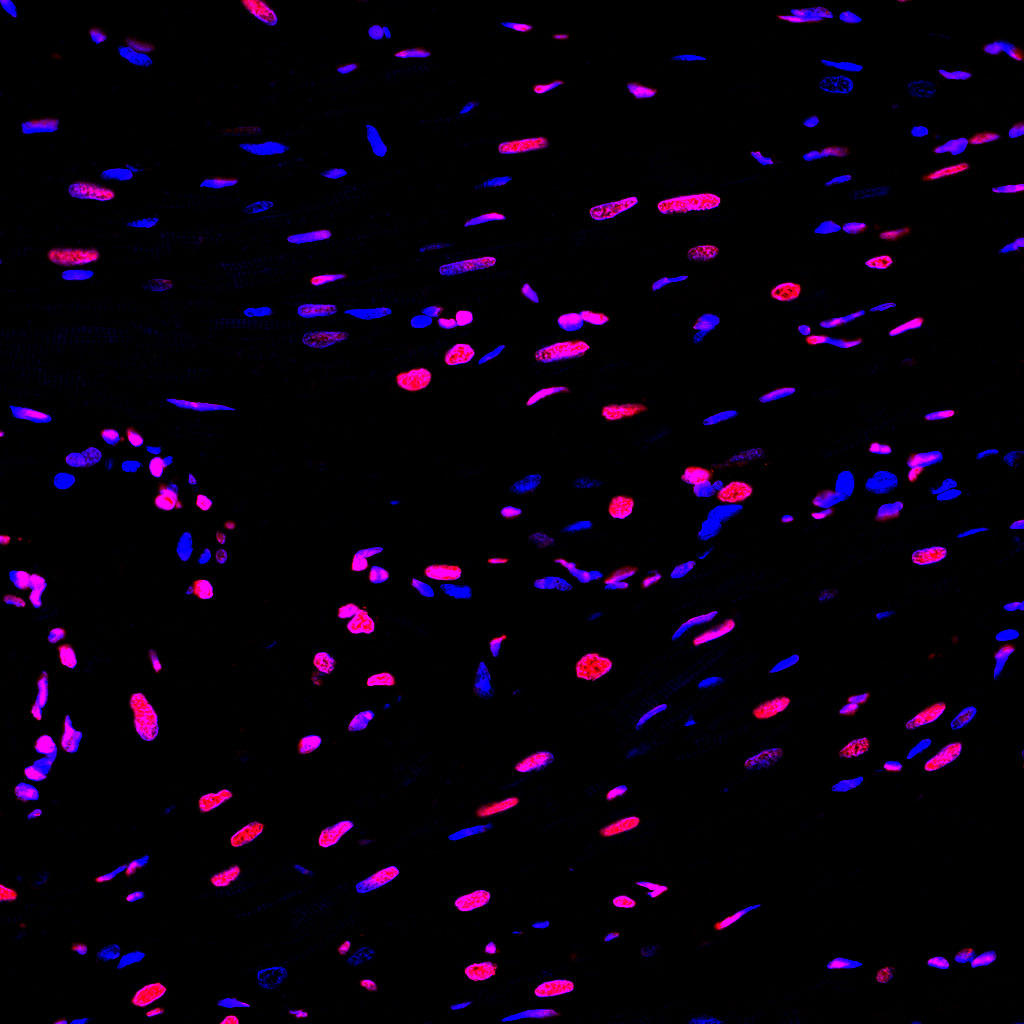 Paraffin embedded rat heart was treated with DNase I to fragment the DNA. DNA strand breaks showed intense fluorescent staining in DNase I treated sample (red). The cells were counterstained with DAPI (blue). This photo was taken by confocal microscope.