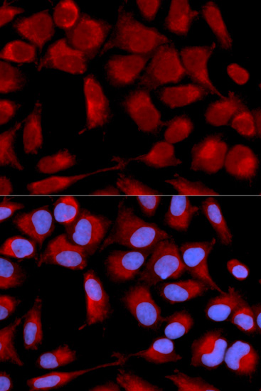 Anti-PDHA1 Antibody (CAB13525)