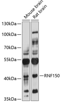 Anti-RNF150 Antibody (CAB3472)