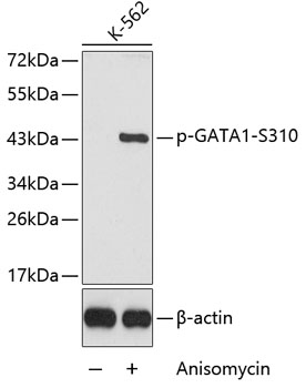 Anti-Phospho-GATA1-S310 Antibody (CABP0354)