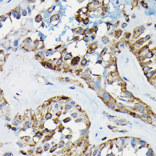 Anti-PRC1 Antibody (CAB7029)