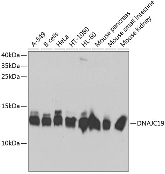 Anti-DNAJC19 Antibody (CAB5146)