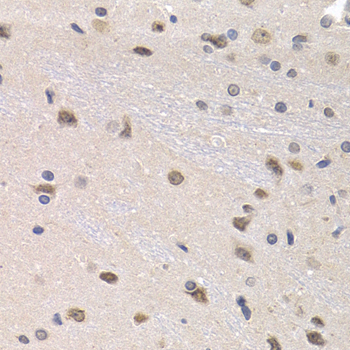 Anti-PTHLH Antibody (CAB1654)