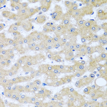 Anti-BCKDK Polyclonal Antibody (CAB8184)