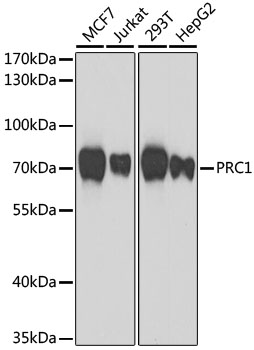 Anti-PRC1 Antibody (CAB7029)