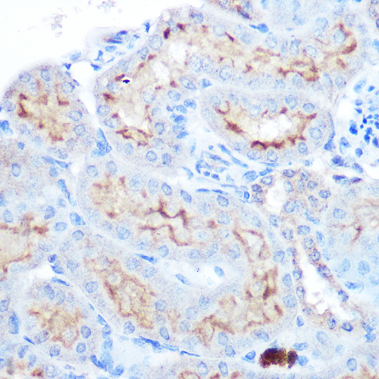 Anti-TNFSF13B Antibody (CAB5858)