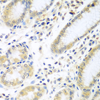 Anti-IL-5 Antibody (CAB7690)