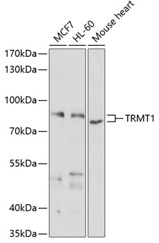 Anti-TRMT1 Antibody (CAB7116)