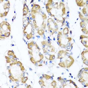 Anti-ST6GAL1 Antibody (CAB5754)