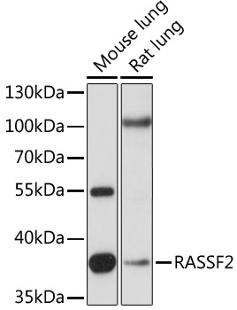 Anti-RASSF2 Antibody (CAB15767)