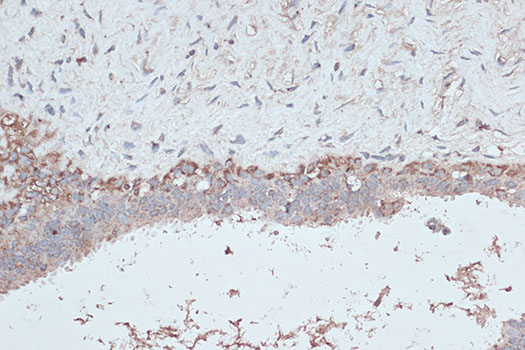 Anti-LC3B Antibody [KO Validated] (CAB7198)