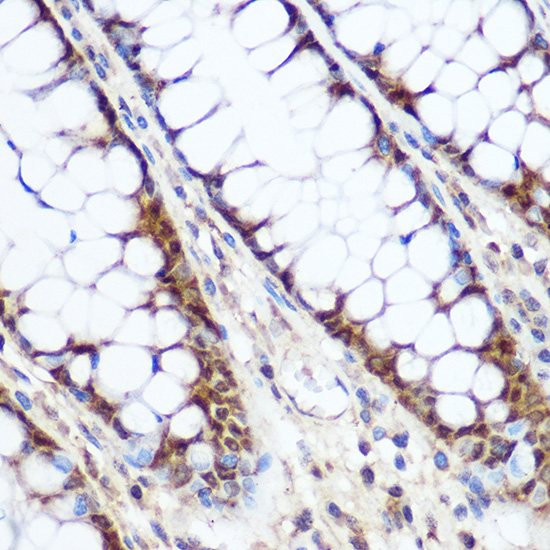 Anti-Cyclin D1 Antibody (CAB11022)