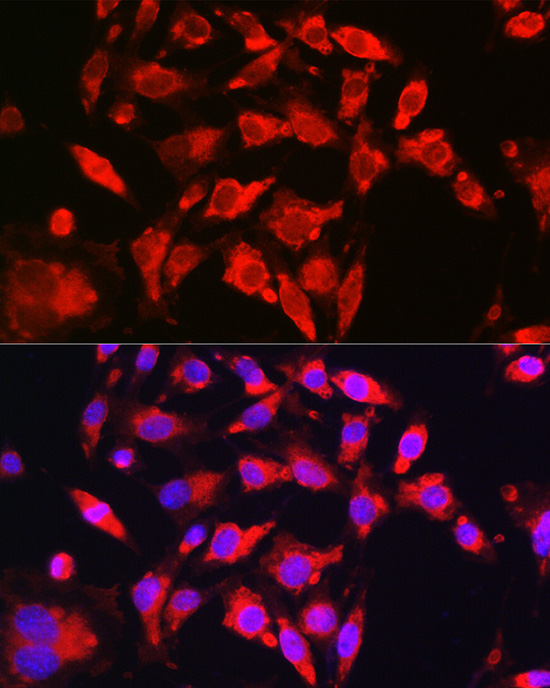 Anti-NRF2 Antibody (CAB1244)