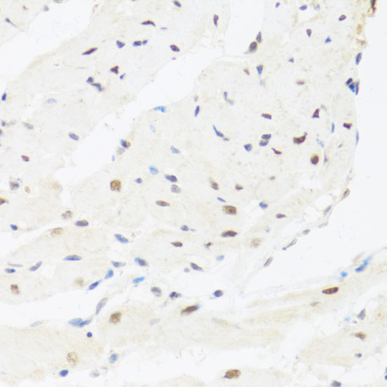 Anti-IRF3 Antibody (CAB2172)