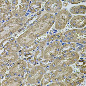 Anti-ANXA8L2 Antibody (CAB7641)