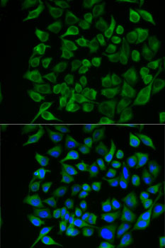 Anti-PAEP Antibody (CAB5751)