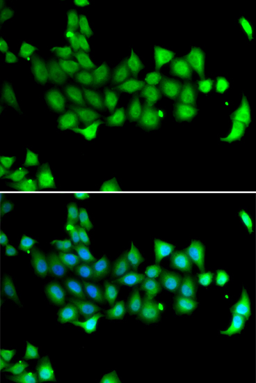 Anti-HSPA14 Antibody (CAB7107)