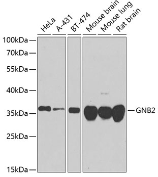 Anti-GNB2 Polyclonal Antibody (CAB8422)