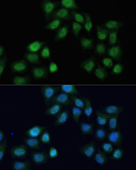 Anti-CREB1 Antibody (CAB11064)